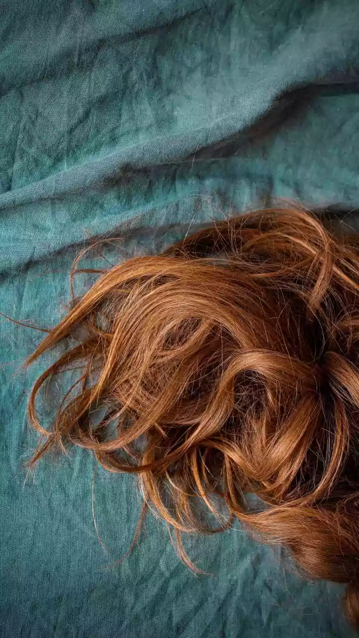 Alopecia Areata: The Truth About Shaving Your Head for Hair Regrowth