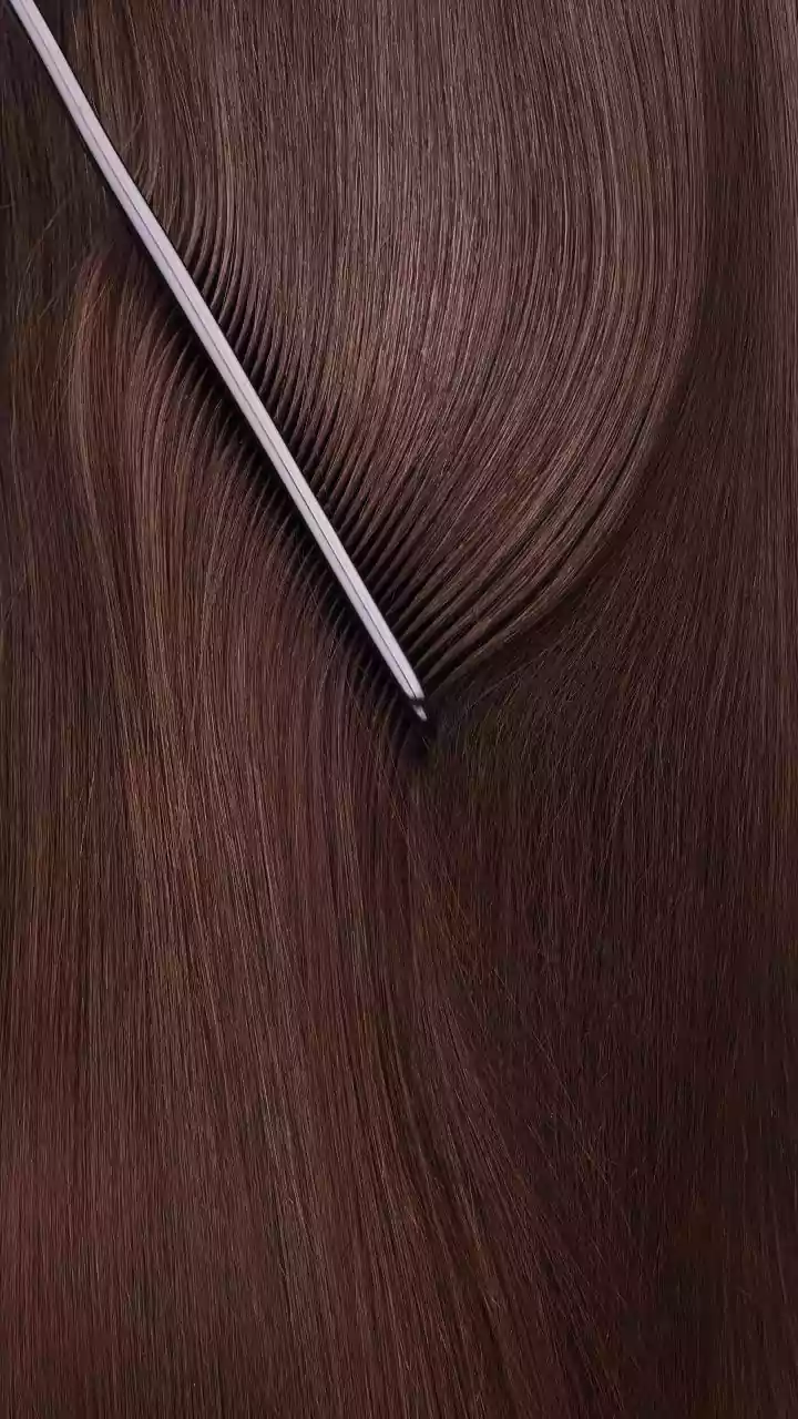 Está ficando calvo? Harvard ensina como amenizar a queda de cabelo