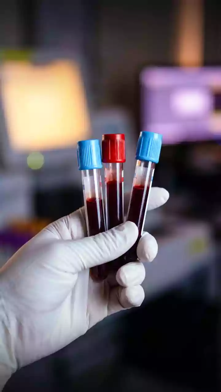 Congo confirma nova epidemia de ebola e registra 13 casos e 4 mortes