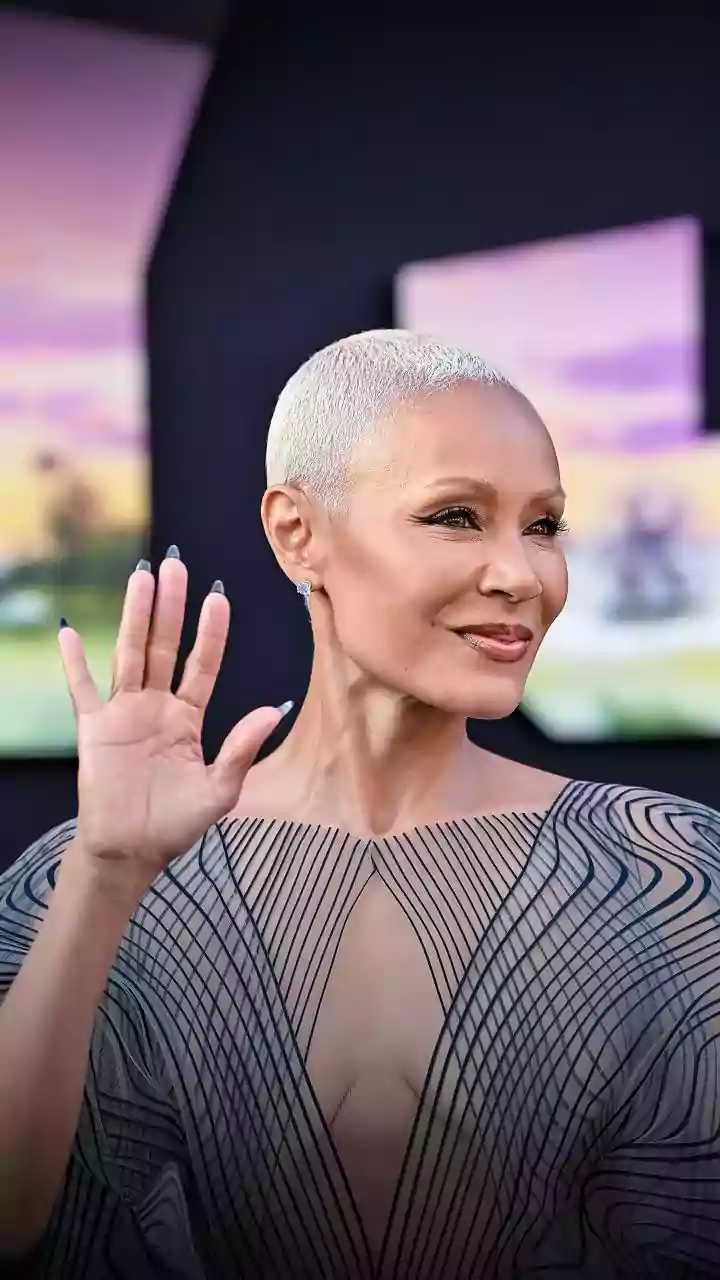 O que é alopecia? Conheça os tipos, causas e tratamentos para a queda de cabelo