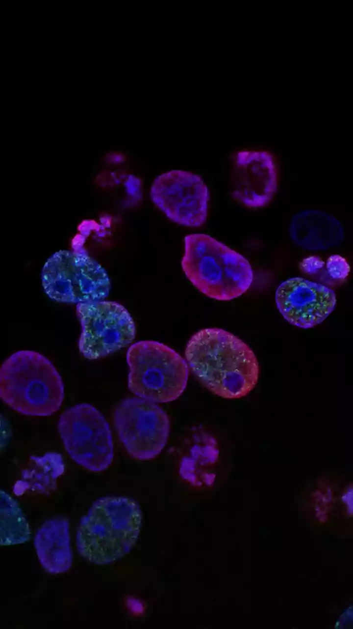 Unlocking Cancer's Self-Destruct: A Scientific Breakthrough