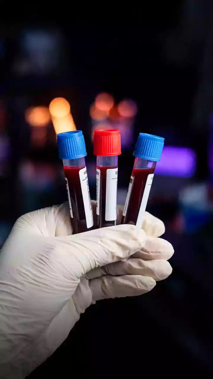 Cientistas descobrem gordura que reduz câncer de pâncreas. Saiba qual