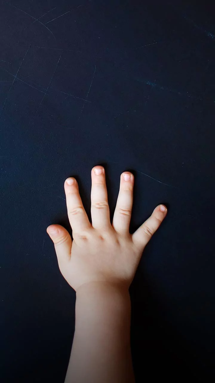 Crianças também têm reumatismo: sintomas que os pais não devem ignorar