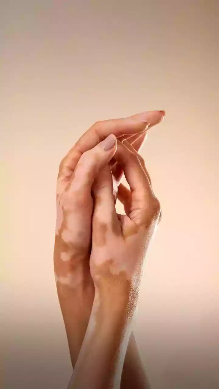 Cracking Your Knuckles: Myth vs. Science on Arthritis and Joint Health