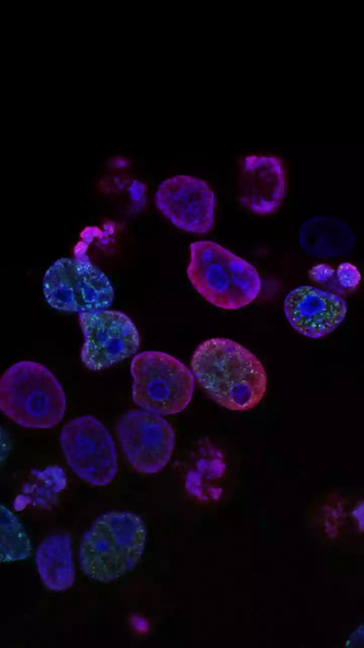 Scientists find a surprising "in-between" state of life and death