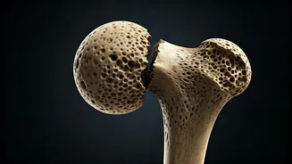 Diet Soda & Bone Health: The Surprising Link