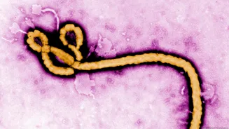 Há risco de o surto de ebola chegar ao Brasil?