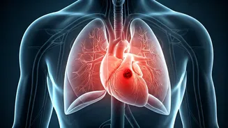 Pulmonary Thromboembolism Explained: Understanding the Deadly Link to Heart Issues