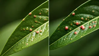 Summer Acne And Monsoon Acne Aren't Identical