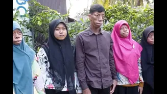 This Family’s ‘Lizard’ Facial Features Is ‘Scary’ Reality No One Wants To Believe In — Locals Say ‘It Keeps Changing’