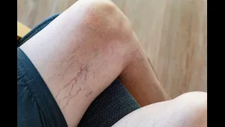 Related Stories banner