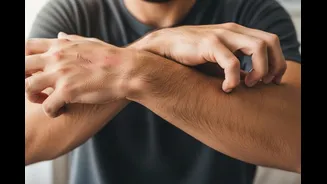 Winter Can Worsen Eczema, Psoriasis And Dry Skin: Expert Tips To Prevent Flare-Ups