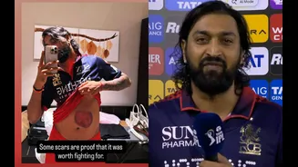 Krunal Pandya shows off his battle scar after match-winning knock in RCB vs MI