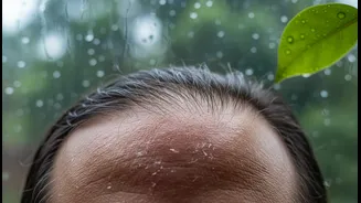 Monsoon Hair Care Mistakes That Could Leave Your Scalp Feeling Uncomfortable