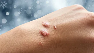 Related Stories banner