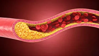 High Cholesterol in India: Understanding the Risks & Management