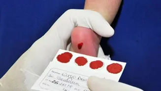 Atraso no teste do pezinho: lei de 2021 ainda não garante diagnóstico da AME em todo o país