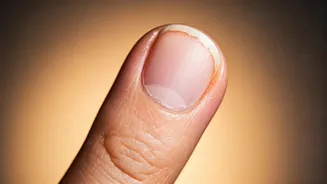 Unraveling Brittle Nails: Causes and Solutions