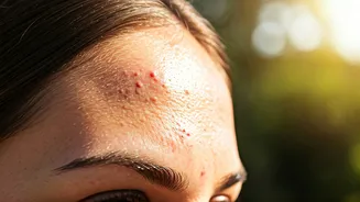 Why High Humidity Breakouts Are Trashing Your Summer Glow