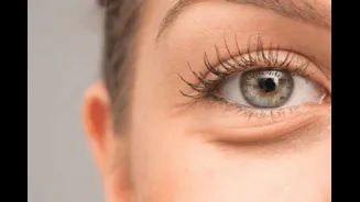 Think Your Eye Bags Are From Lack Of Sleep? Think Again