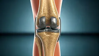 The Rise of Early Knee Replacements: Why 40-Somethings Are Opting for New Knees