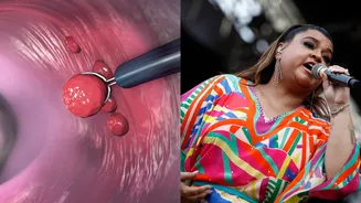 Até 2030, 127 mil pessoas podem morrer da mesma causa que Preta Gil; entenda