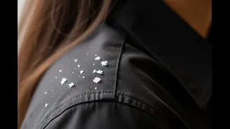 White Flakes On Your Shoulders? Here’s How To Tell Dandruff From Dry Scalp