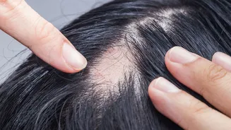 O que é alopecia? Conheça os tipos, causas e tratamentos para a queda de cabelo