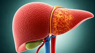 Liver Disease Epidemic: Nearly 2 Billion to be Affected by 2050!