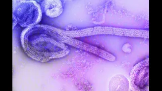 Surto de ebola pode chegar ao Brasil? Saiba o que dizem especialistas