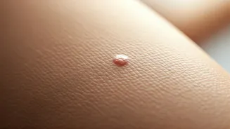 Summer Skin Woes: Decoding Acne Stages and When to See a Dermatologist