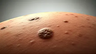 Unusual Skin Spots: What Your Moles and Patches Are Trying to Tell You