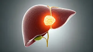 Dipika Kakar's Health Battle: Recurrence of Liver Cyst Leaves Her Anxious and Separated from Son