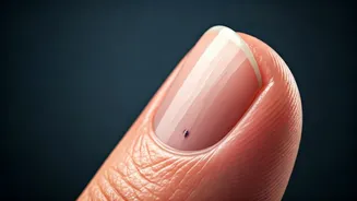 The Ominous Nail Line: Unpacking the Warning Signs of Subungual Melanoma