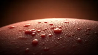 Is it fungal acne? How to tell