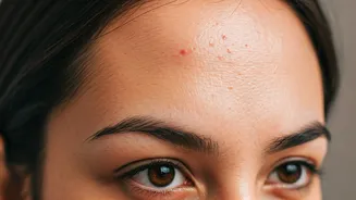 Forehead Breakouts? Discover Why Your Hair Oil Might Be Causing Acne