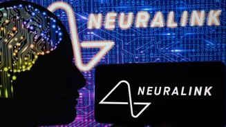 This soft brain chip could solve Neuralink's biggest implant problem