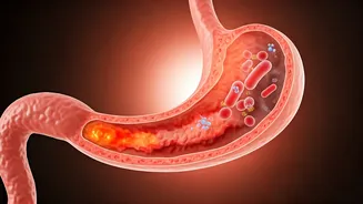 Heartburn Persisting? Harvard Doc Unveils Two Overlooked Causes Beyond Antacids
