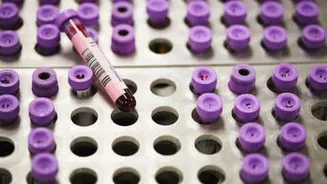 New guidelines recommend all adults get this heart test