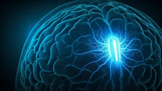 Brain Implants: Bridging the Gap to Independence, But Guarding Against New Risks