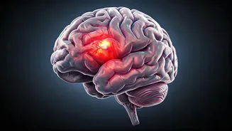 Brain Aneurysms: Understanding the Condition and Its Symptoms
