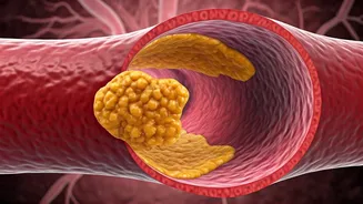 Heart Health: Unveiling Arterial Plaque & Reversal Tips