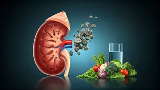 Rethinking Kidney Stone Prevention: Beyond Just Drinking More Water