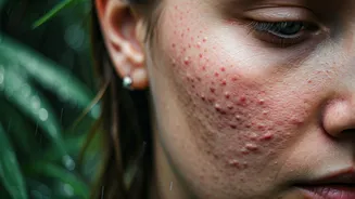 Don't Ignore These Common Monsoon Skin Warning Signs