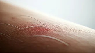 Saree Cancer: The Unseen Skin Risk from Tight Draping Explained