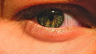 How Environmental Factors Like Dry Air Combine With Intense Screen Exposure To Cause Sudden Eye Strain