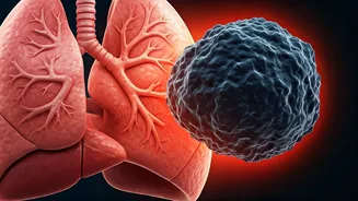 Sudden Collapse: Unraveling the Mystery of a Fatal Lung Blood Clot