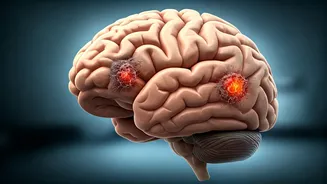 Common Infections: The Surprising Link to Accelerated Dementia Risk