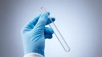 Lab leak fears in Russia! 1 dead, 200 under watch