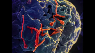 Ebola no Brasil: o que se sabe sobre os casos suspeitos investigados no país